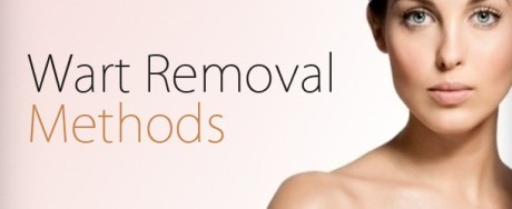 wart removal home remedies